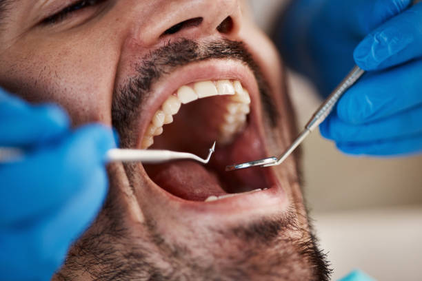 Best Dental Exams and Cleanings  in Jamestown, NY